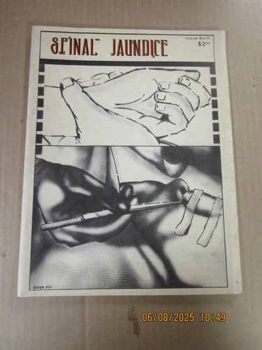Spinal jaundice used 90 s - #11, used!
